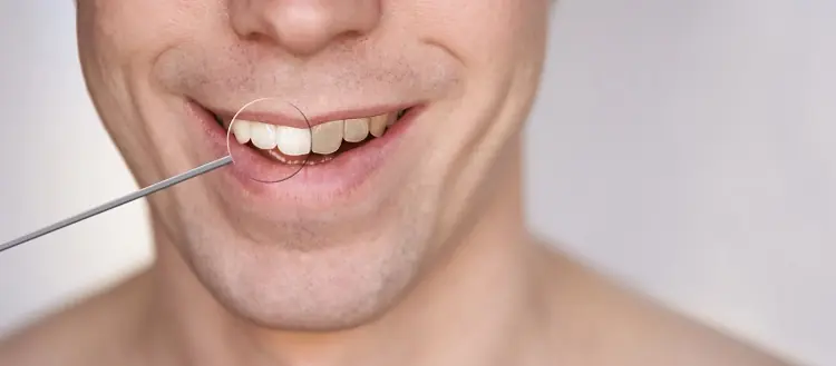 ¿Por qué se oscurecen nuestros dientes?