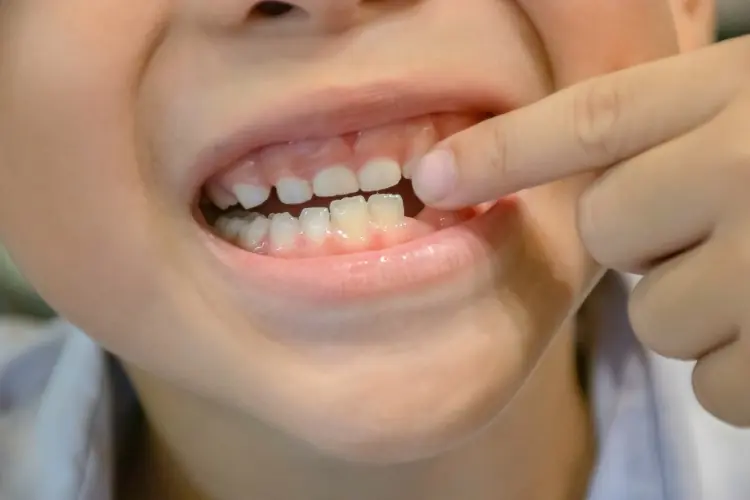 ¿Por qué perdemos nuestros dientes de leche? ¿Qué función cumplen en nuestra boca?