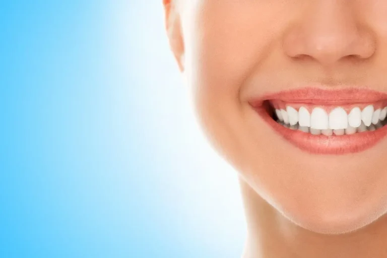 ¿Qué alimentos tiñen nuestros dientes y cómo cuidarlos?