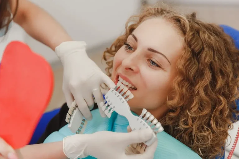 ¿Qué diferencia a las carillas de las coronas dentales?