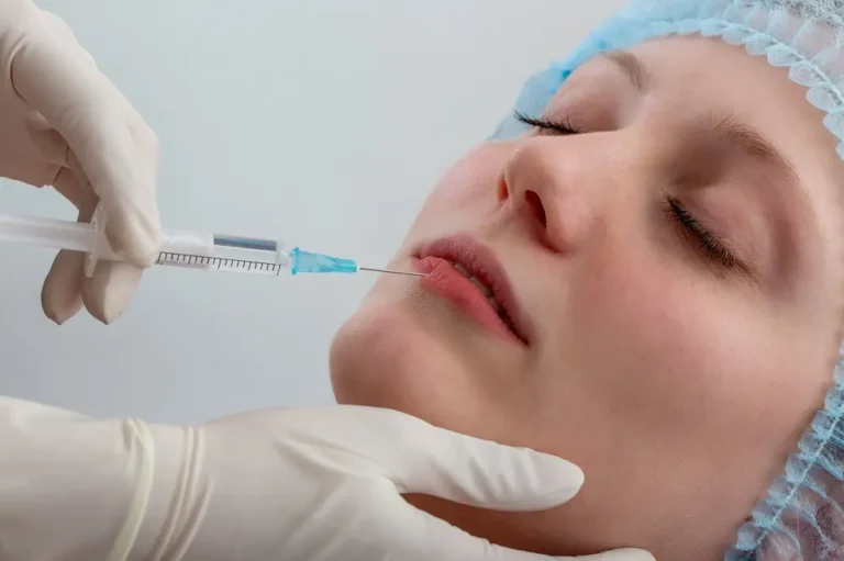 Beneficios del ácido hialurónico en los labios