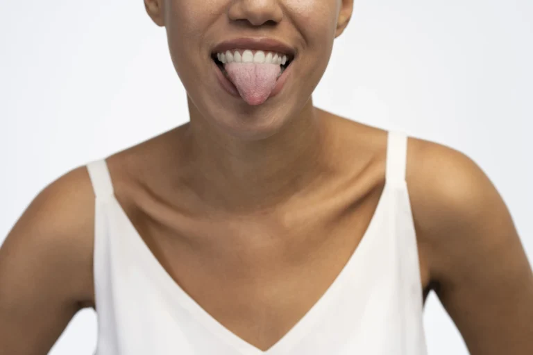 ¿Cómo limpiar la lengua blanca para eliminar el mal aliento?