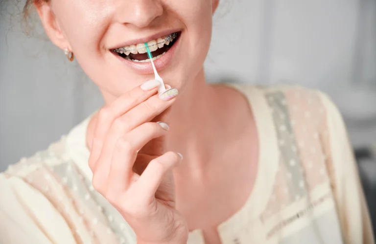 Hilo Dental Para Ortodoncia: Prácticas Y Recomendaciones