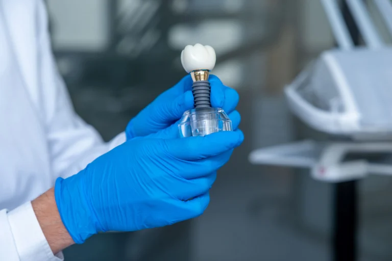 Lo Que Necesitas Saber Sobre Cómo Se Ponen Los Implantes Dentales