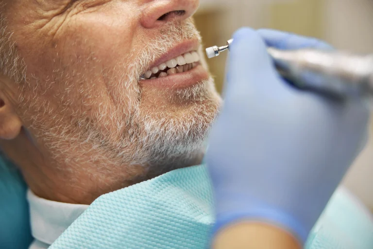 Implante dental, puente dental o prótesis removible cómo elegir la mejor opción en toledo mingari